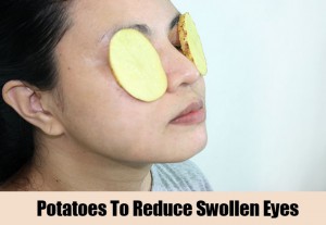 Potatoes-To-Reduce-Swollen-Eyes